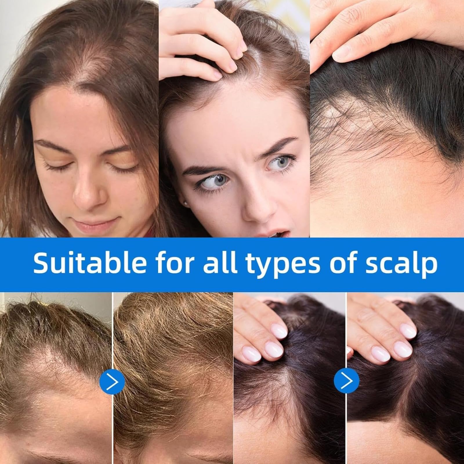 Seapuari Scalp Serum – Contro La Caduta, Volume E Radici Rafforzate. Mantiene Il Cuoio Capelluto Pulito. Ideale Per Uso Quotidiano Su Capelli Fragili (Uomo/Donna) (4 PCS)