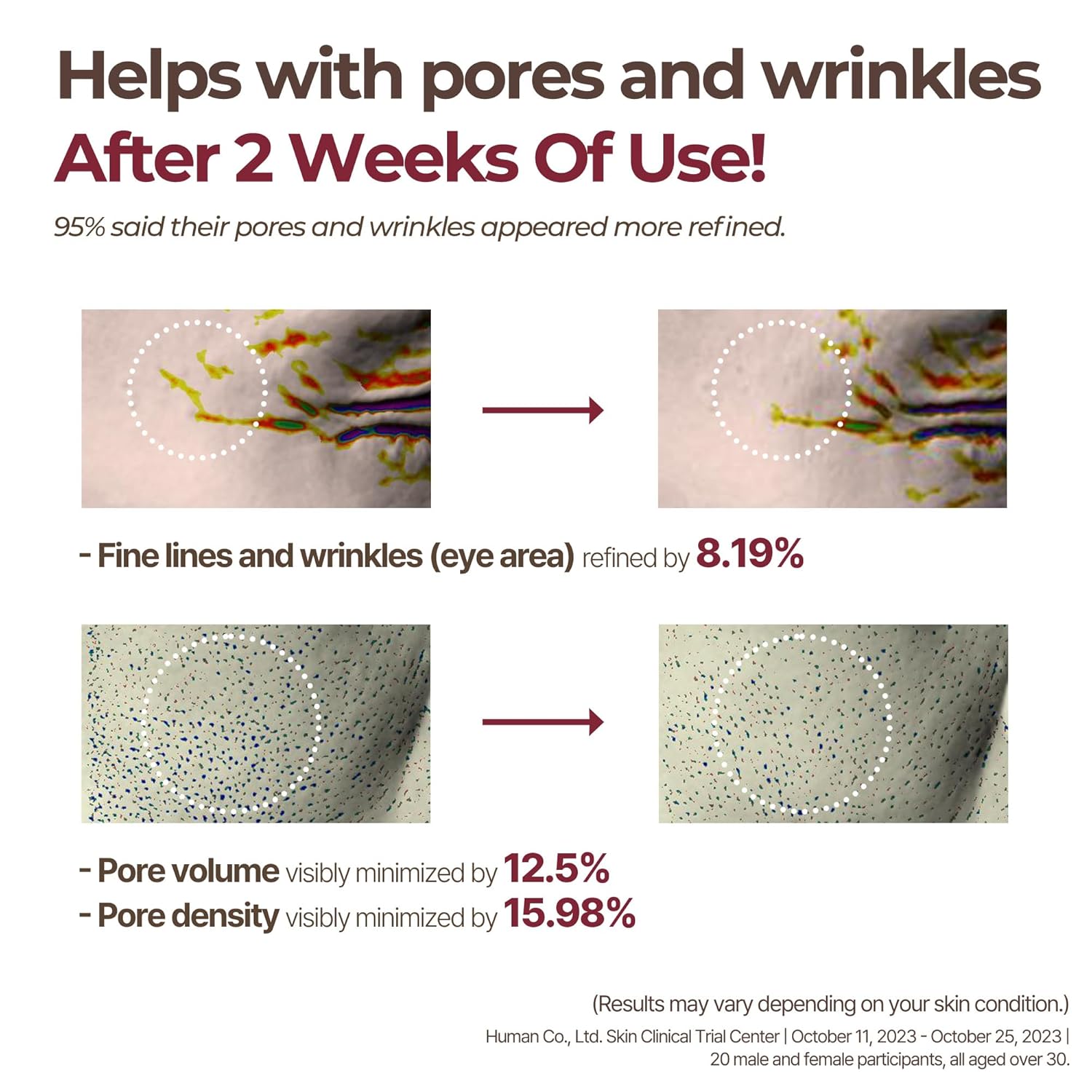 NMN Radiant Cream, All In One Anti Aging Cream for Wrinkles, Sagging Skin, Pores, and Uneven Skin Tone – Clinically Tested Korean Skincare, 50ml, 1.69 fl. oz.