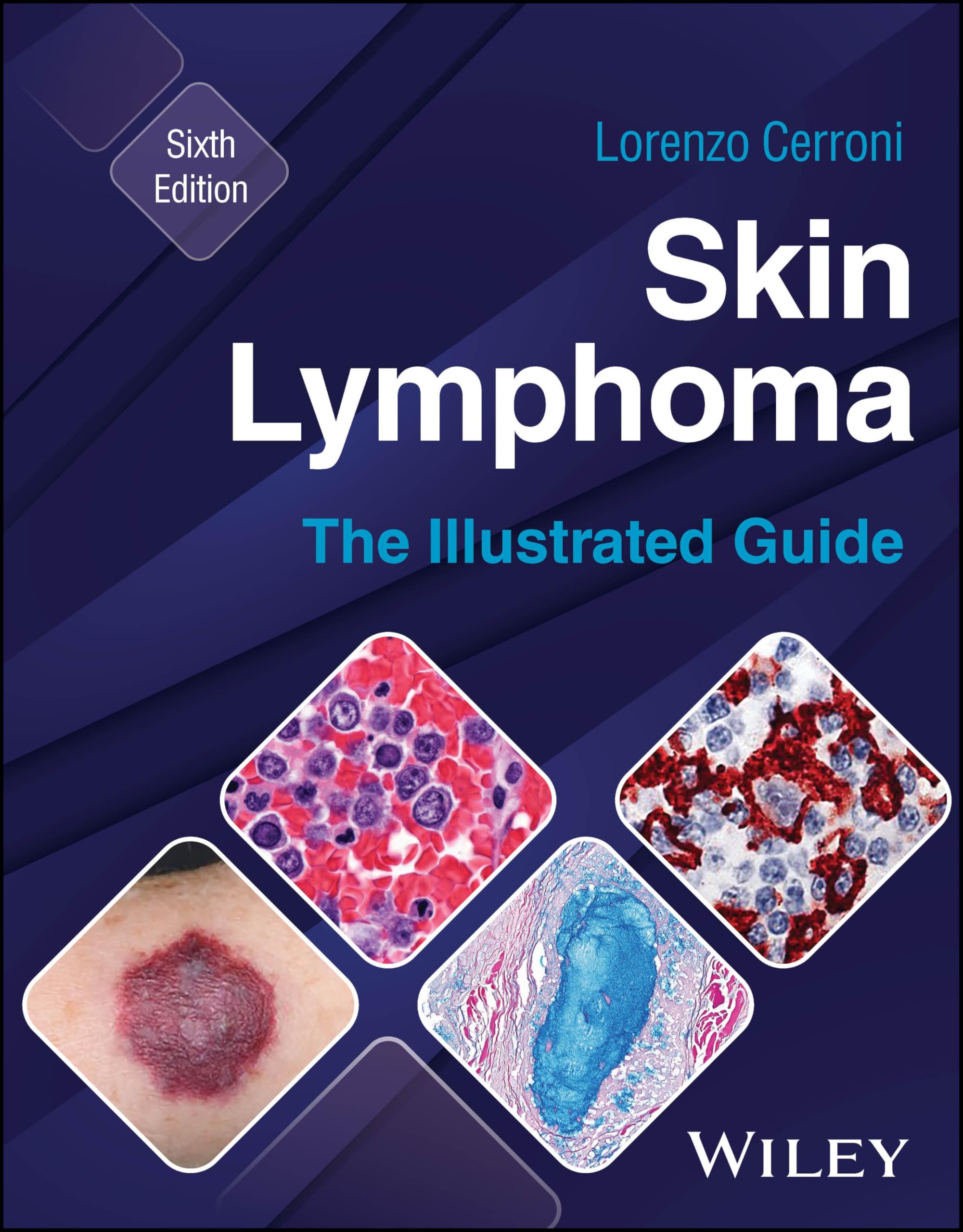 Skin Lymphoma: The Illustrated Guide