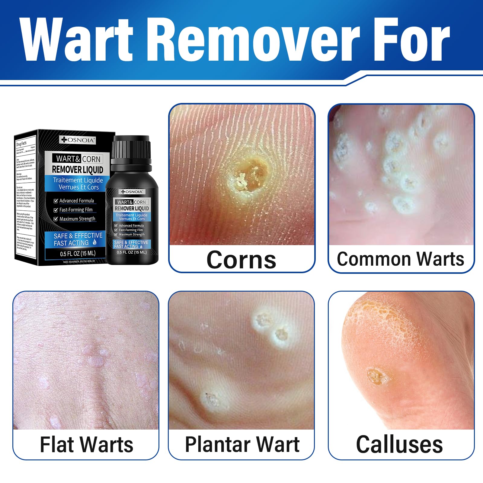 Extra Strength Wart Remover Liquid with 17% Salicylic Acid, Fast Acting Treatment for Plantar & Common Warts, Corn Remover for Feet and Toes, 15ml - 3