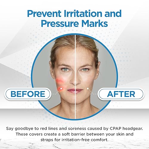 Miniatura 3 de Cojín para CPAP de RespLabs con correa suave para una mayor comodidad, universal, evita la irritación de la piel y reduce el enrojecimiento