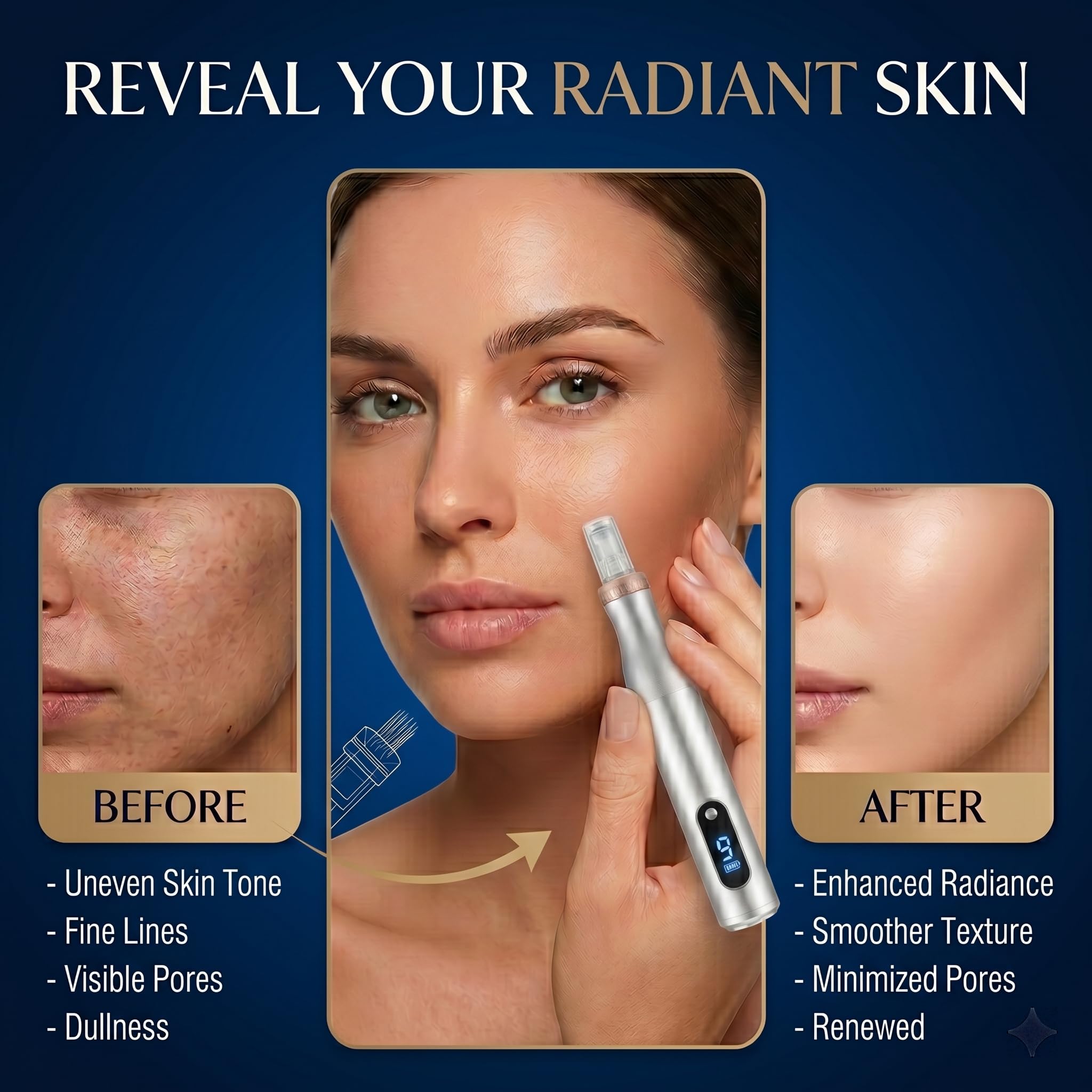 Microneedling Pen for Home Use,Microneeding Derma Roller Pen for Women Men - Micro Needle Roller Pen for Skin Tools