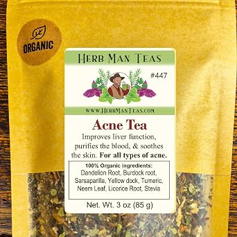 ACNE TEA Traditionally Used to Support Clear Skin & Complexion with Burdock, Dandelion, Neem & Turmeric Premium Organic Loose Leaf Formulated by Master Herbalist Khabir