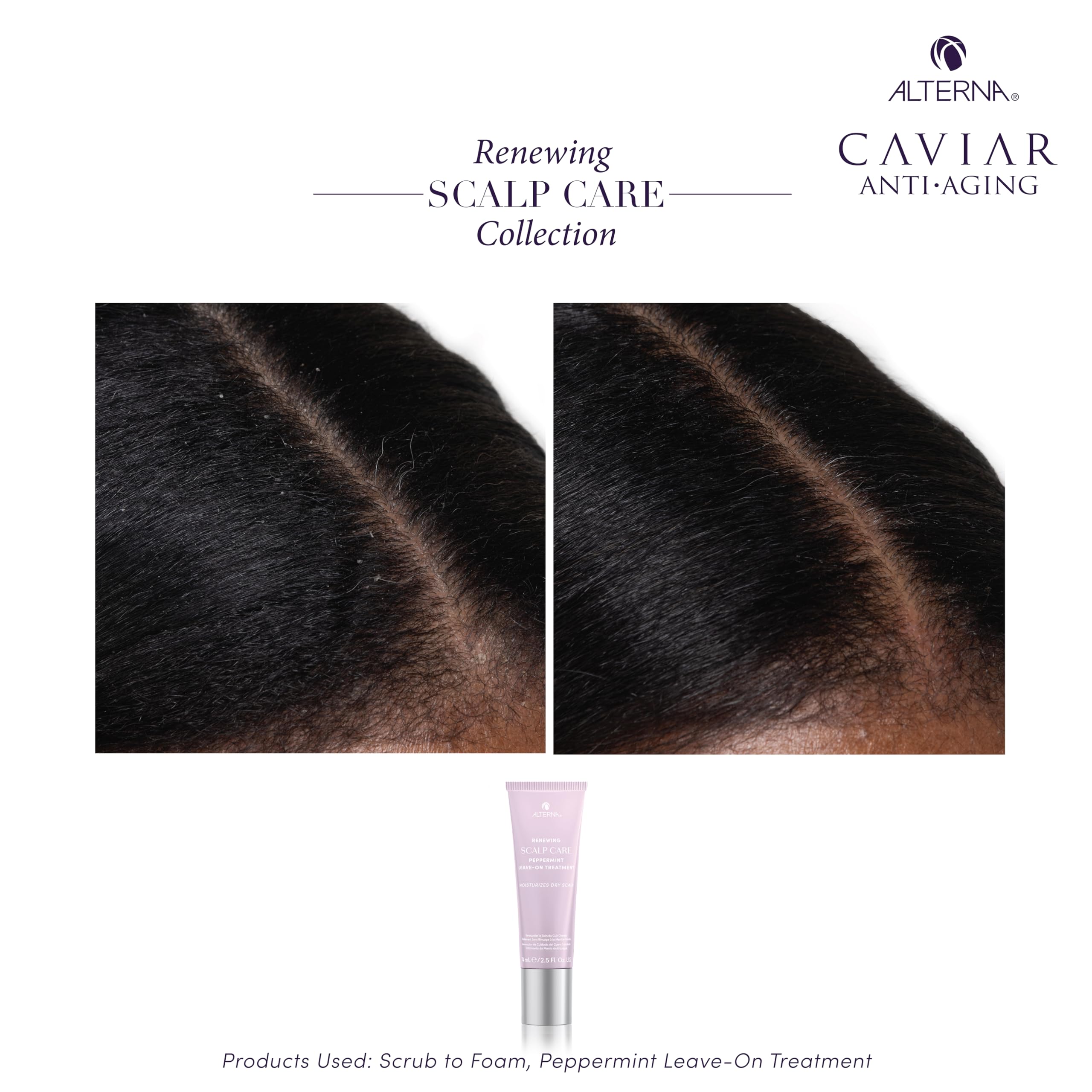 Alterna Haircare Renewing Scalp Care Peppermint Leave on Scalp and Hair Treatment, 2.5 Fl Oz Lightweight and Fast Absorbing to Moisturize and invigorate Scalp