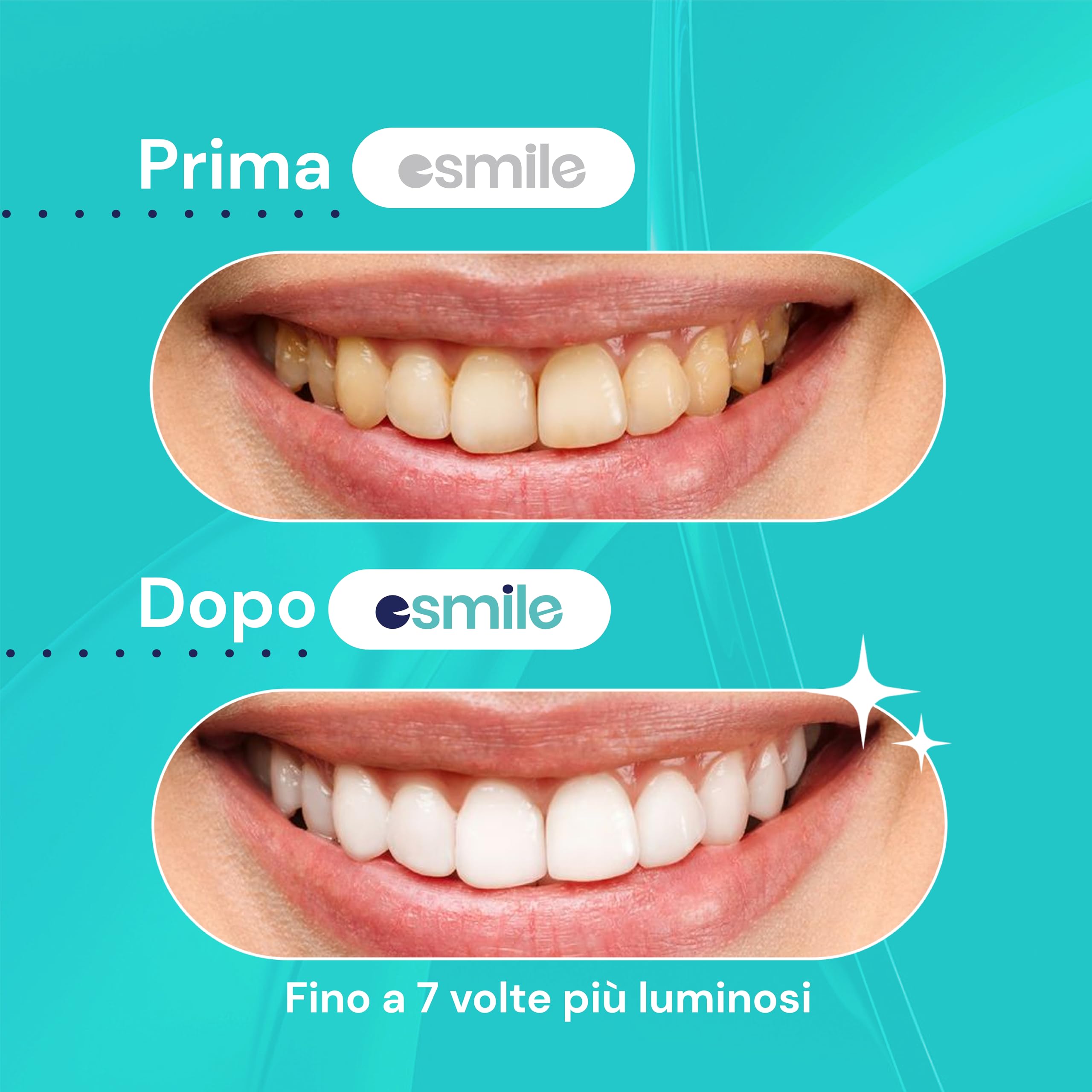 ESMILE: Kit Pro lampada led+ Strisce sbiancanti + Carbone v34
