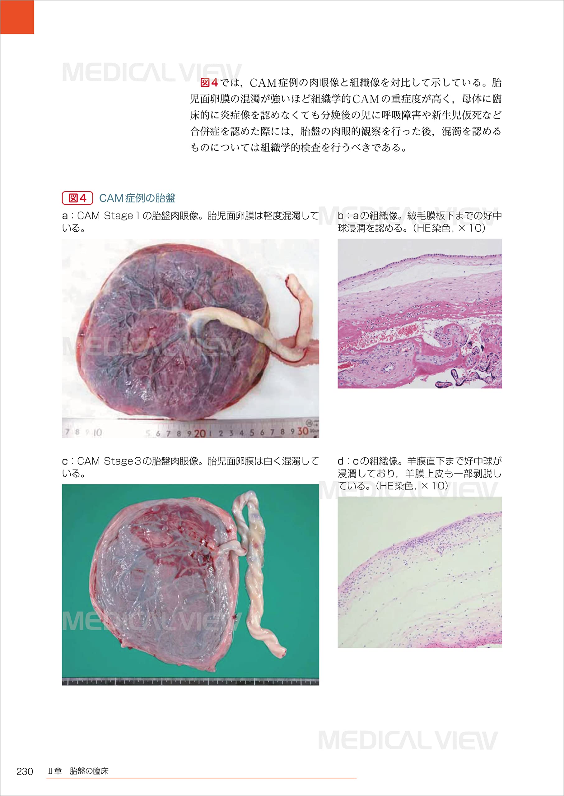 基礎と臨床の両側面からみた 胎盤学 日本胎盤学会 本 通販 Amazon