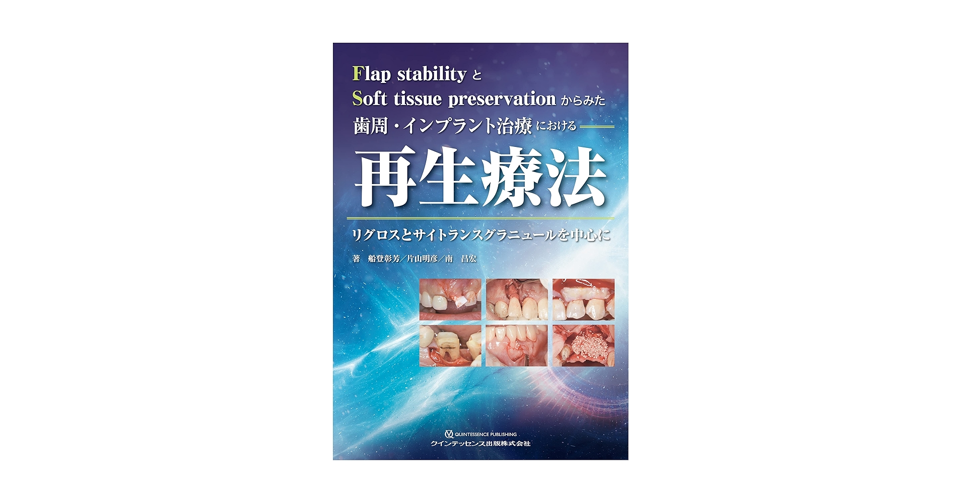 マサヨシ　裁断済み　歯周・インプラント治療における再生療法 歯周・インプラント治療における再生療法 - クインテッセンス出版