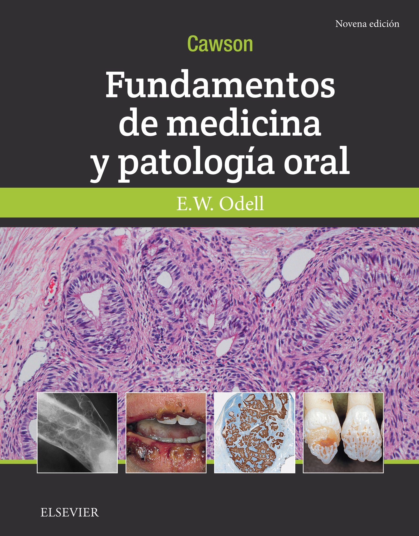 Cawson. Fundamentos de medicina y patología oral - 9ª edición
