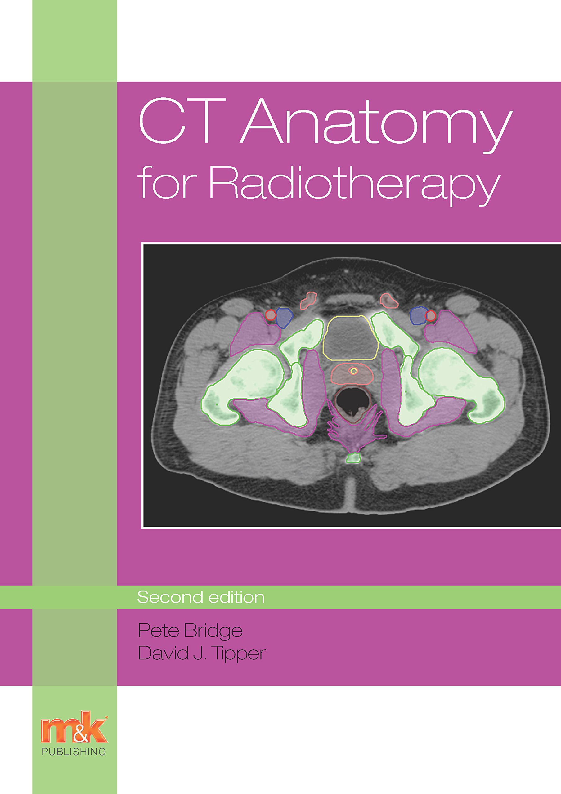 CT Anatomy for Radiotherapy (English Edition)