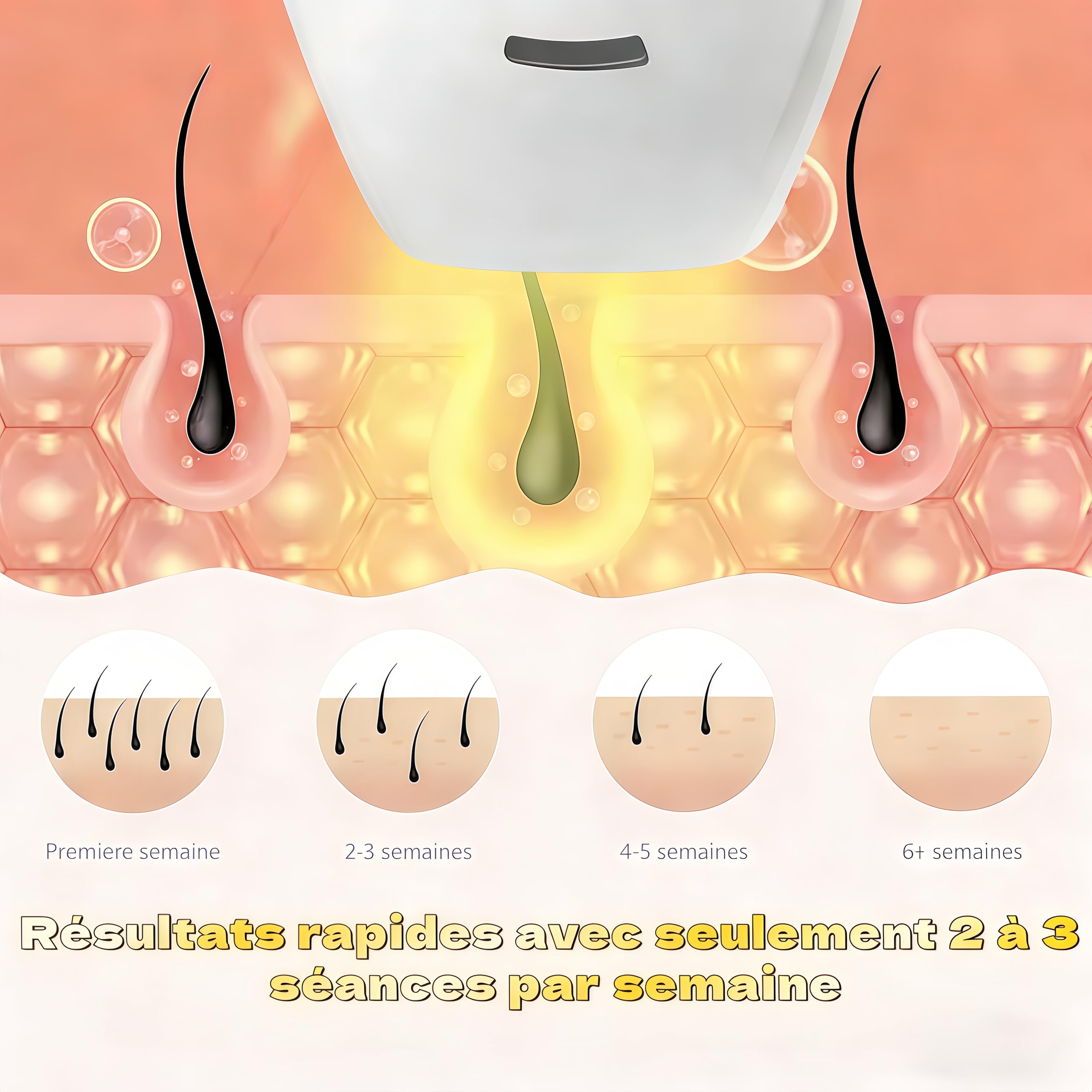 Solippy LOOP Appareil d'Épilation IPL, Épilation Laser Indolore, Lumière Pulsée pour Épilation Définie du Visage, Corps, Bikini et Aisselles, Épilateur Électrique Pratique et Efficace
