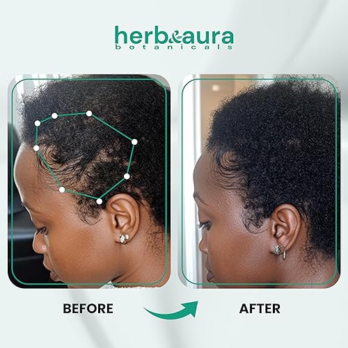 Miniatura 7 de Aceite de batana sin refinar para el crecimiento del cabello puro y orgánico de Honduras, aceite de botana crudo para cabello fino y raíces débiles,