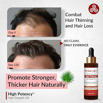 High Potency® Hair Growth Oil – Hair Defence Pro Formula | 20% Clinically Proven Actives including Procapil, Redensyl, Capilia Longa, Rosemary, Saw Palmetto, Jojoba, Pumpkin Seed Oil