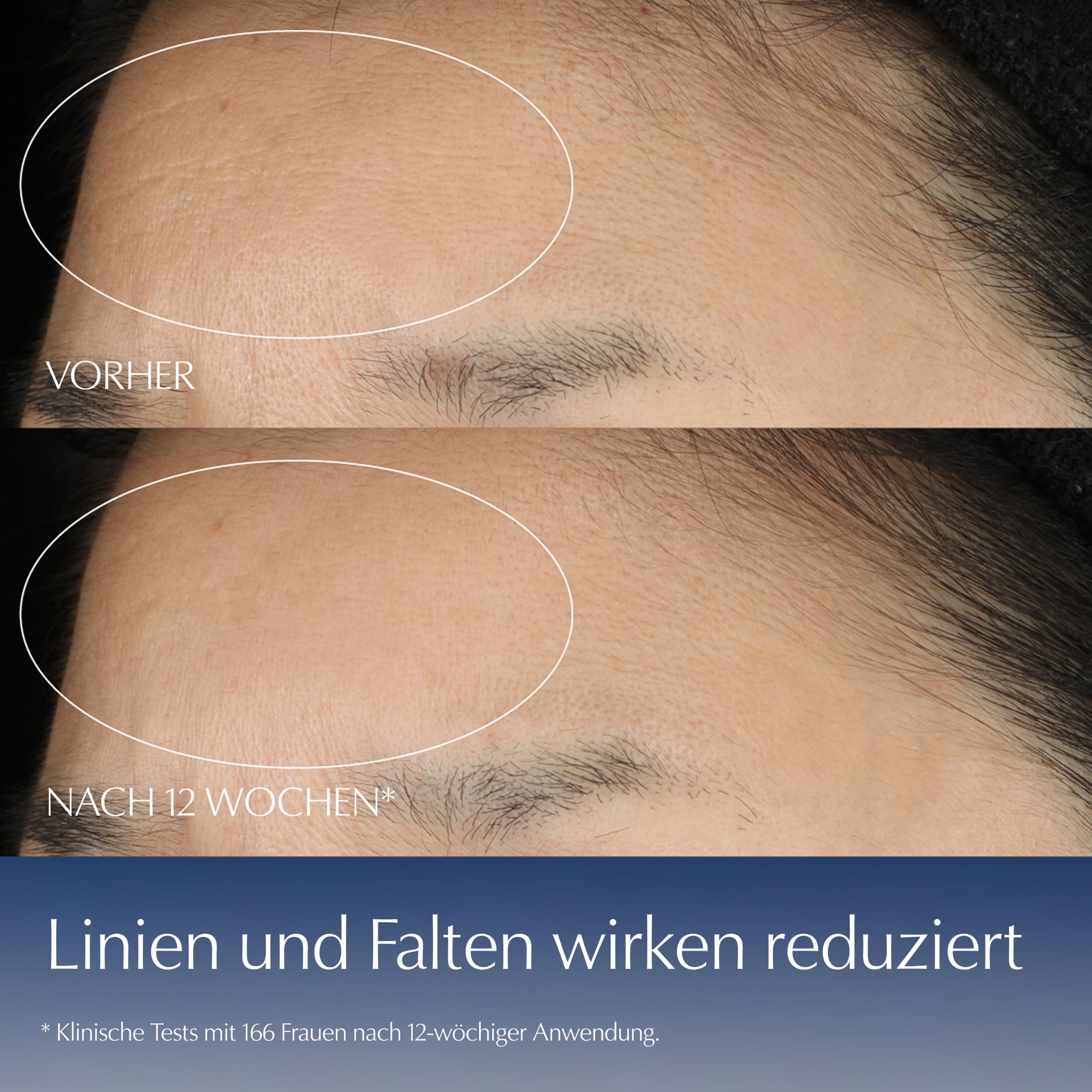 Estée Lauder Advanced Night Repair Synchronized Multi-Recovery Complex | Gesichtsserum mit Hyaluron & Peptiden | Für glattere, strahlendere & ebenmäßigere Haut | Für jeden Hauttyp, 115ml