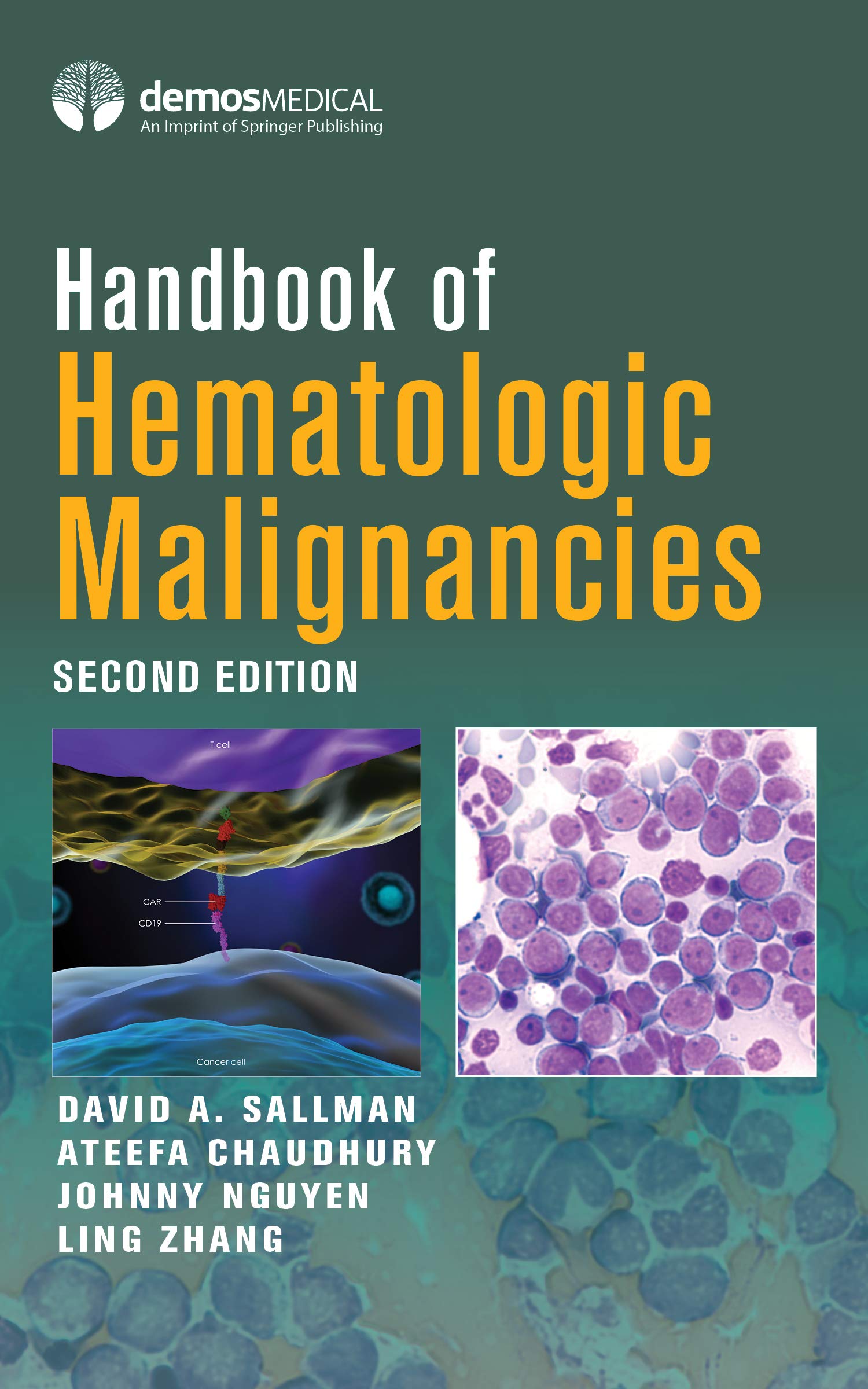 Handbook of Hematologic Malignancies, Second Edition (English Edition)