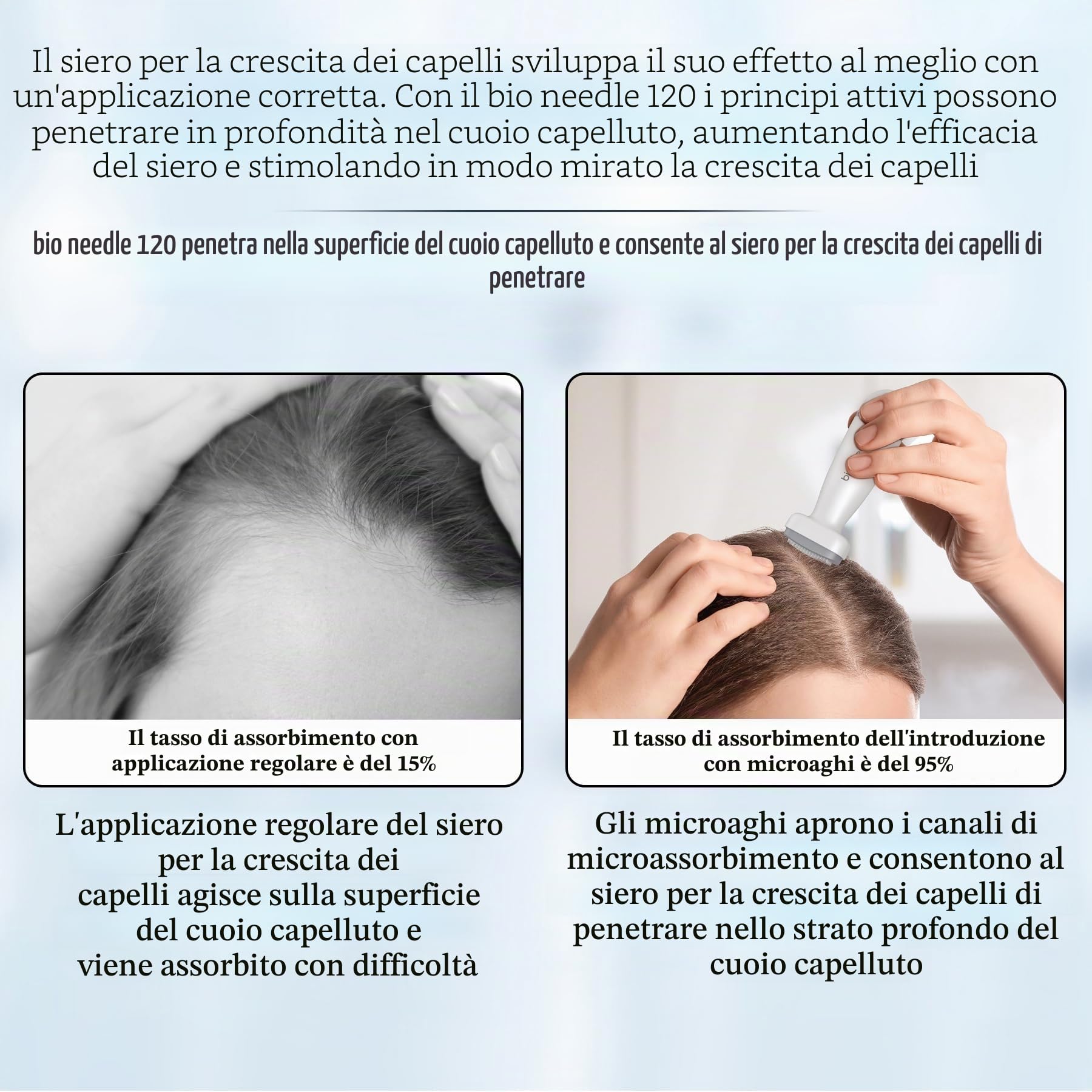 P-Beauty Derma Stamp - Microneedling - Mesoroller con 120 aghi in acciaio inox di alta qualità, lunghezza regolabile 0-2 mm, per anti-invecchiamento, rigenerazione della pelle, crescita dei capelli