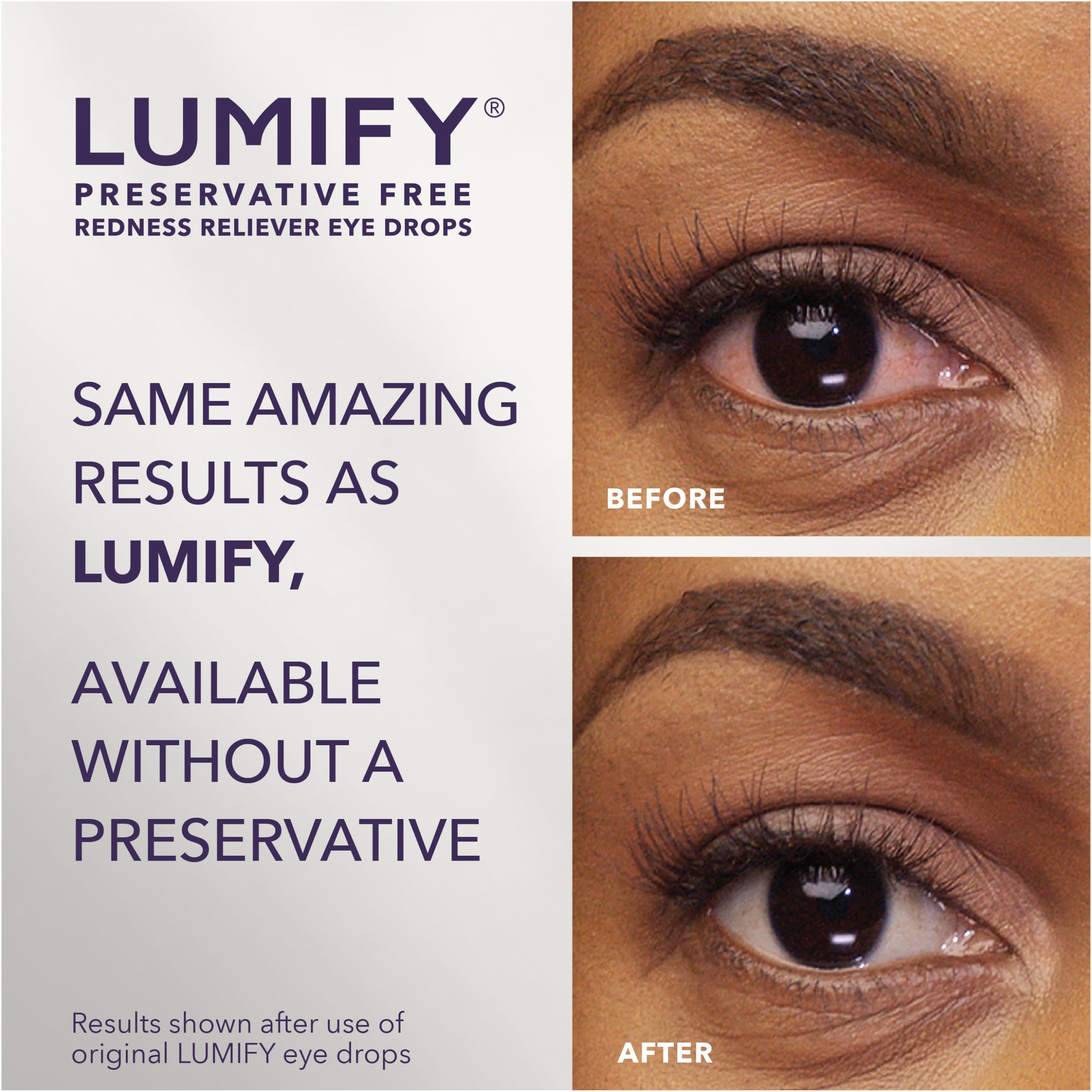 Lumify Preservative Free Eye Drops Redness Relief, Sensitive Eyes, 20 Vials — Amazon image 2
