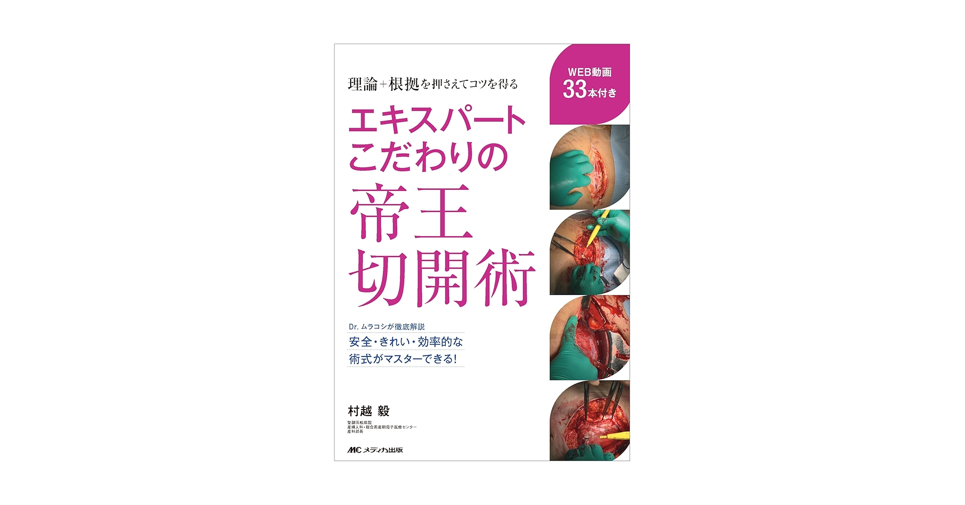 エキスパートこだわりの帝王切開術 エキスパートこだわりの帝王切開術：理論＋根拠を押さえてコツを得る