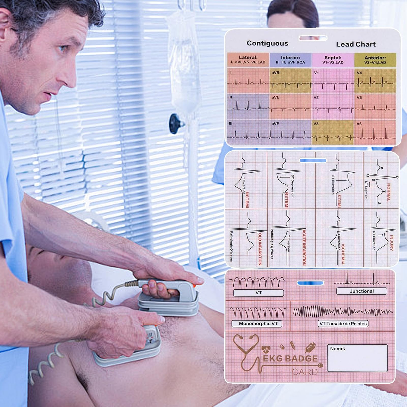 Riferimento badge ECG - Flashcard infermieristica, tre pezzi ECG, guida al ritmo cardiaco, tabella di informazioni rapide cliniche, strumento di valore del laboratorio medico | Scheda di
