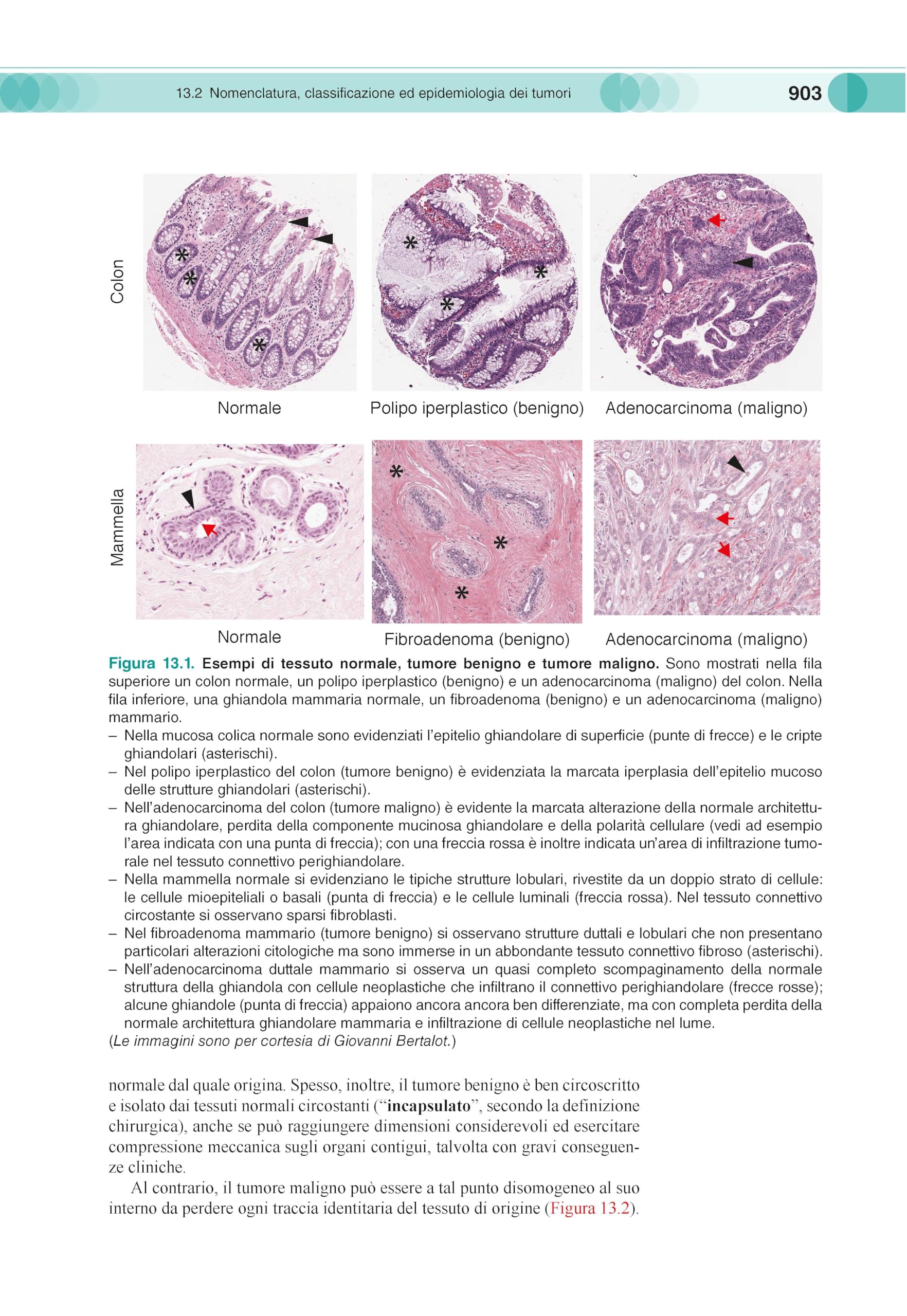 Patogenesi. Basi genetiche e molecolari delle malattie