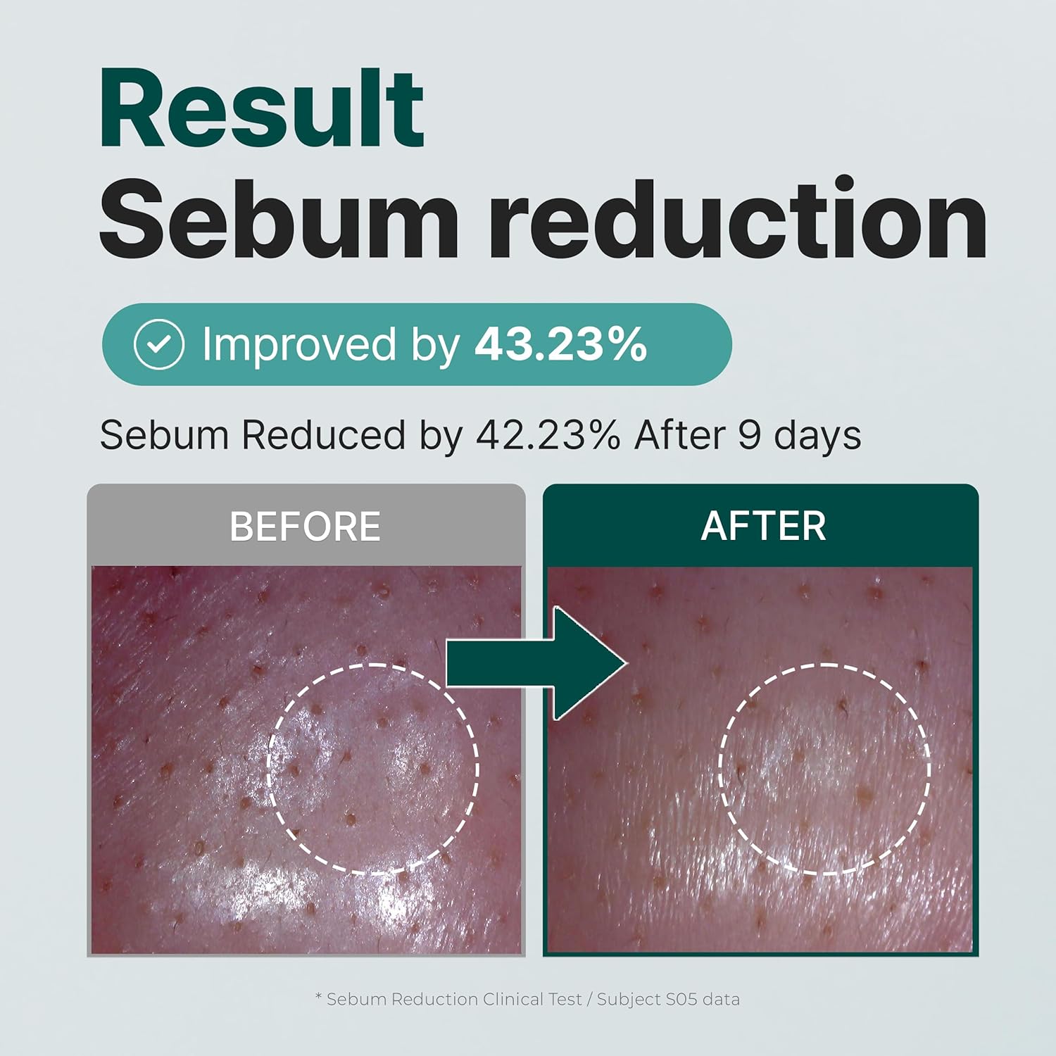 9 Toner - Soothing, Moisturizing, Sebum Control with Mugwort Extract for Sensitive, Dry, Oily Skin – Reduces Redness, Whiteheads, Blackheads - Korean Skin Care (300ml / 10.14 fl.oz) - Image 3