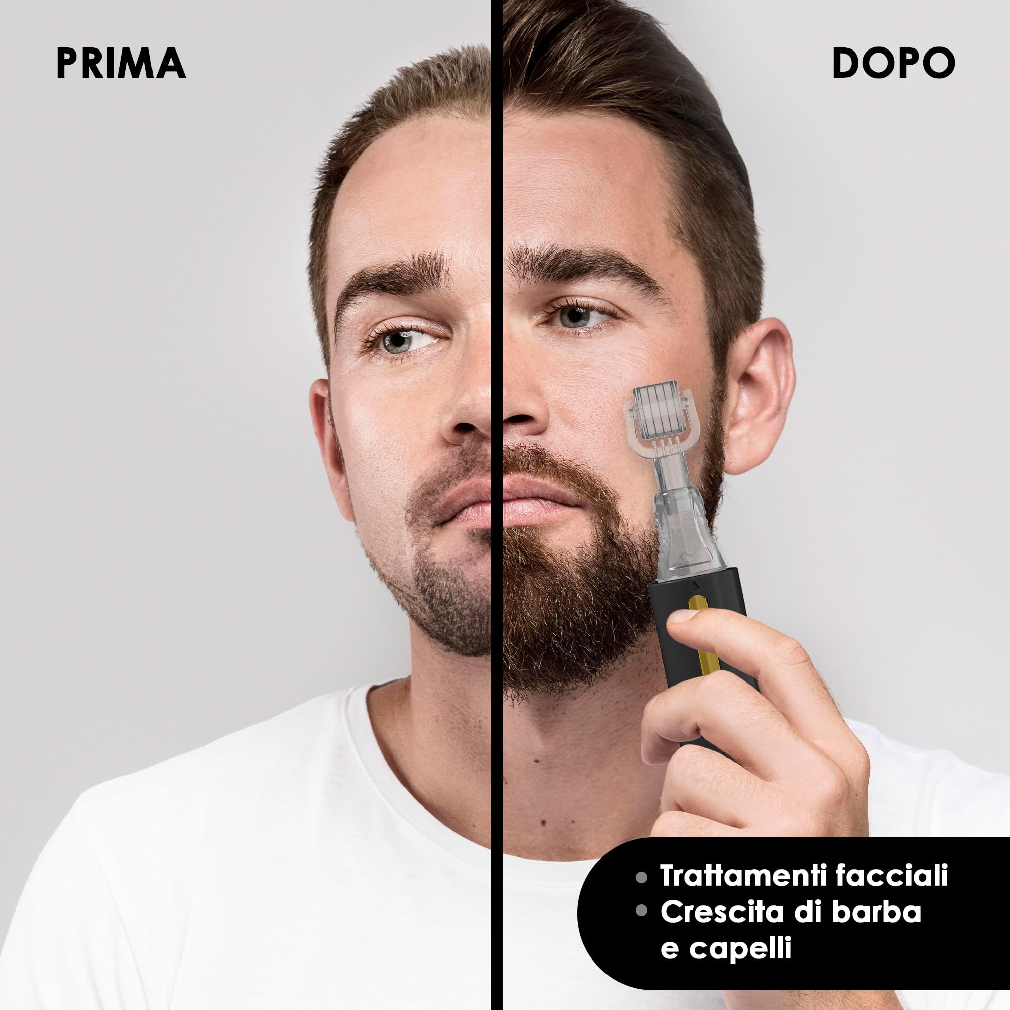 HAMINOS Derma roller 0,5 mm con Serbatoio per Capelli, Barba, Pelle, Rughe, Smagliature, Iperpigmentazione APPLICAZIONE DEL SIERO ISTANTANEO, 105 aghi in titanio