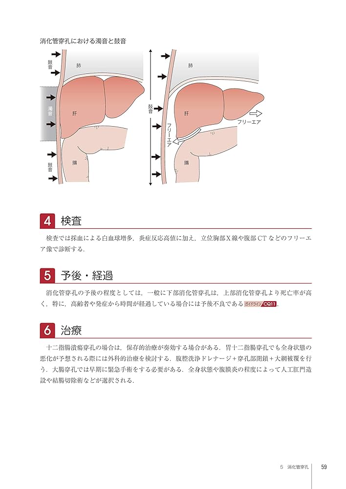ここまでわかる急性腹症のＣＴ 第２版 楽天市場】ここまでわかる急性腹症のct 第2版の通販