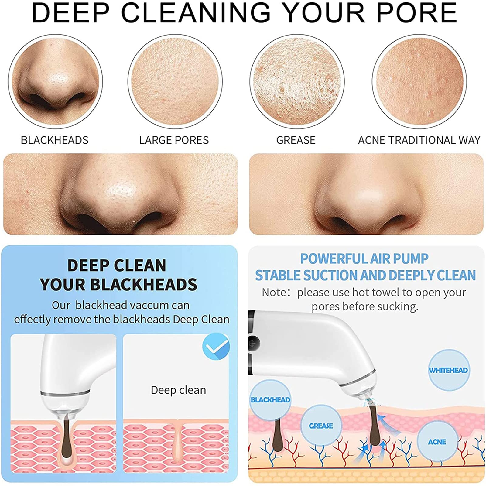 WolFum Limpiador facial de poros: extractor de espinillas de limpieza facial, aspiradora de poros para eliminar puntos negros, herramienta de succión de puntos negros, herramienta extractora de puntos