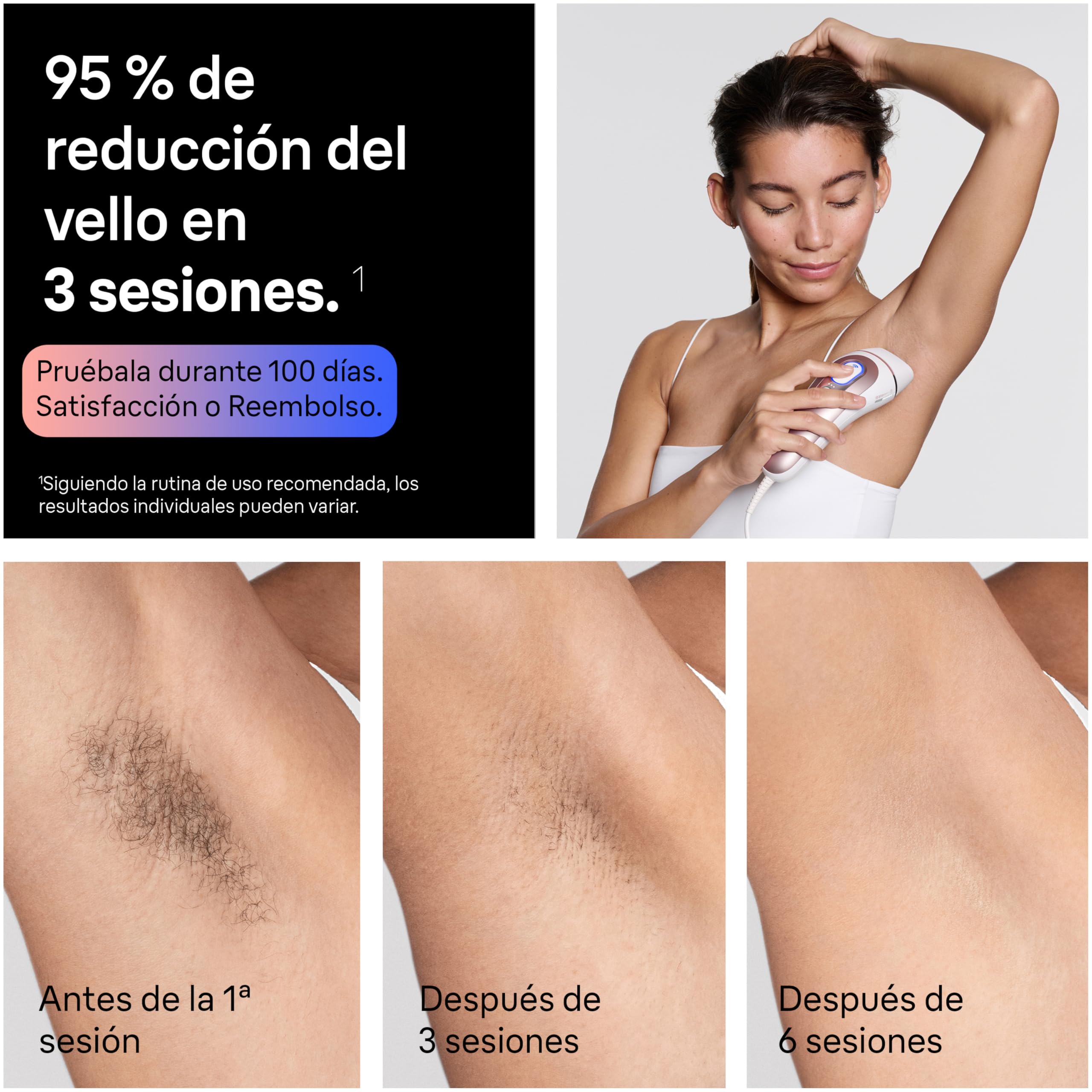 Braun Depiladora Luz Pulsada Smart IPL Skin i·expert, Depiladora Laser con 4 Cabezales, Neceser Y Maquinilla Venus, Reducción Permanente del Vello, Depilación Láser en Casa, PL7431, Blanco/Bronce