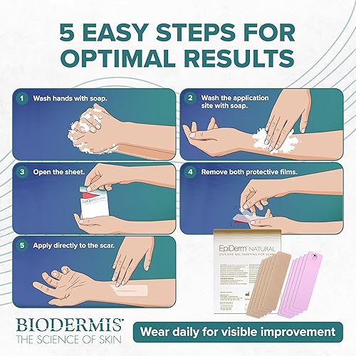 Miniatura 8 de Epi-Derm C-Strips, láminas de gel de silicona para cicatrices, ideal para cesáreas, abdominoplastia, histerectomía y cicatrices de cirugía cardíaca,