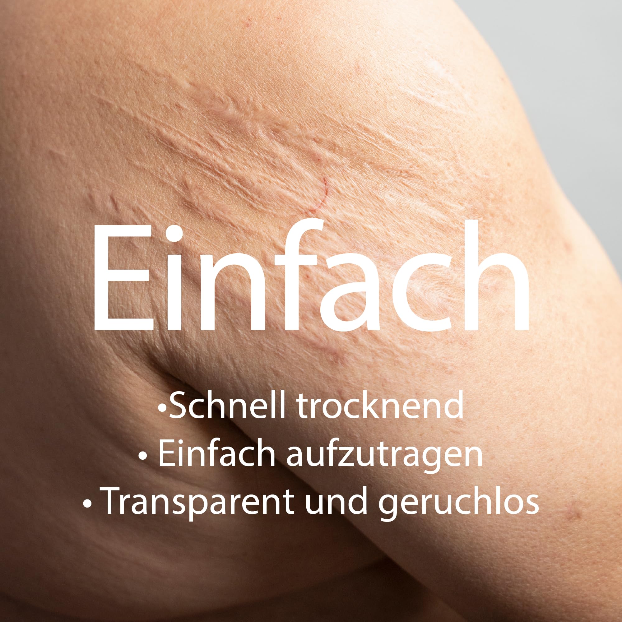 KELO-COTE UV SPF30 Silikon-Narben-Gel 6g mit Sonnenschutz, für chirurgische Narben, erhabene, wulstige Narben wie hypertrophe Narben und Keloide, Verletzungen
