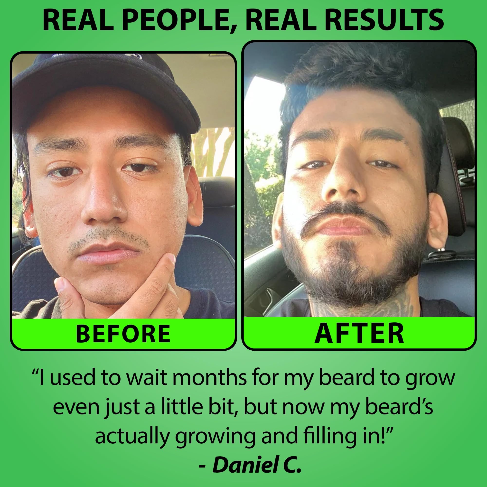 Beard GROW XXL & Beard Minoxidil Bundle for Men – Beard Growth Oil + 5% Minoxidil Serum with 2X Biotin & Rice Water – Thickens, Fills Patchy Areas & Promotes Fuller Facial Hair