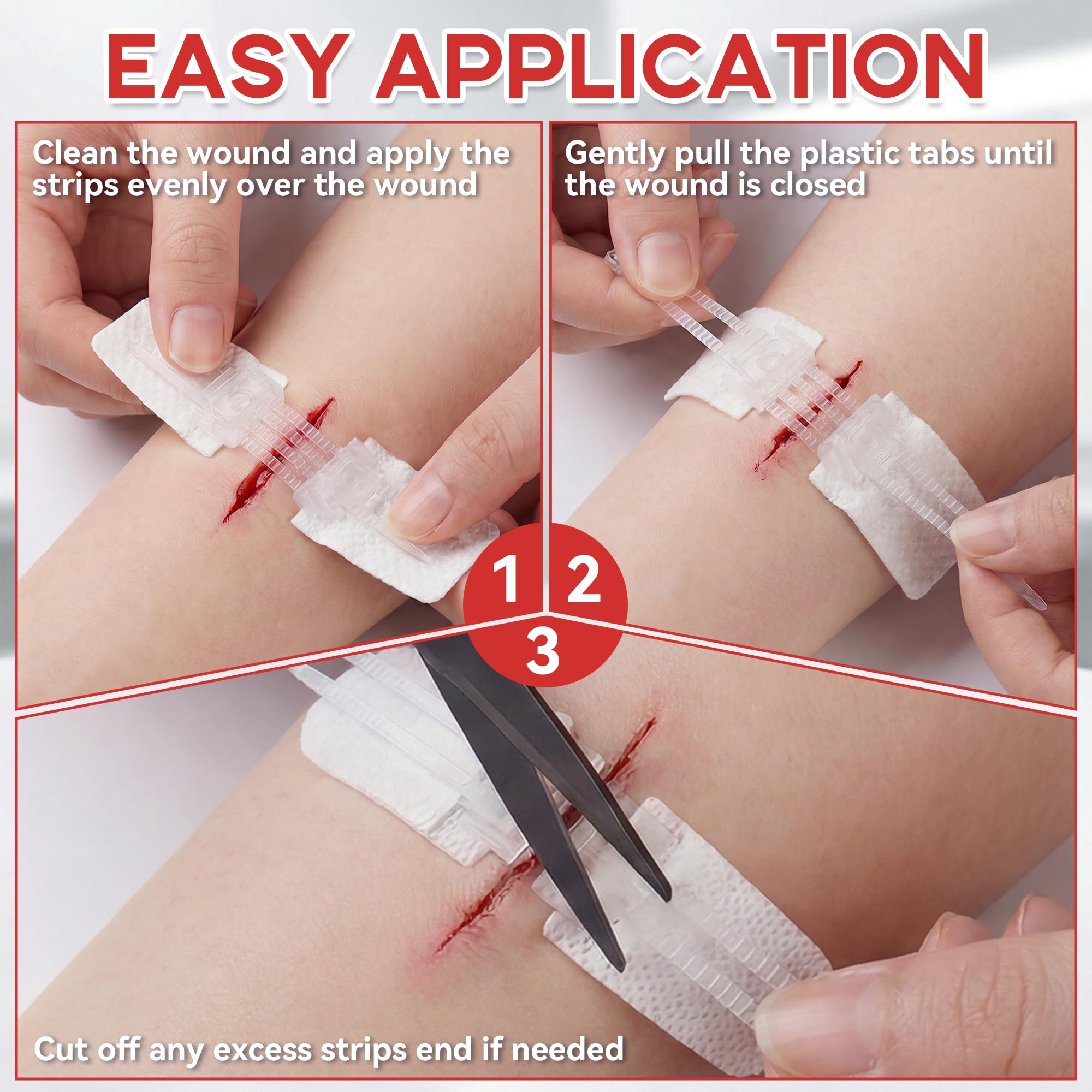 3 PCS Wound Closure Strips, Adjustable Needle-Free Skin Closure Strips — Amazon image 3