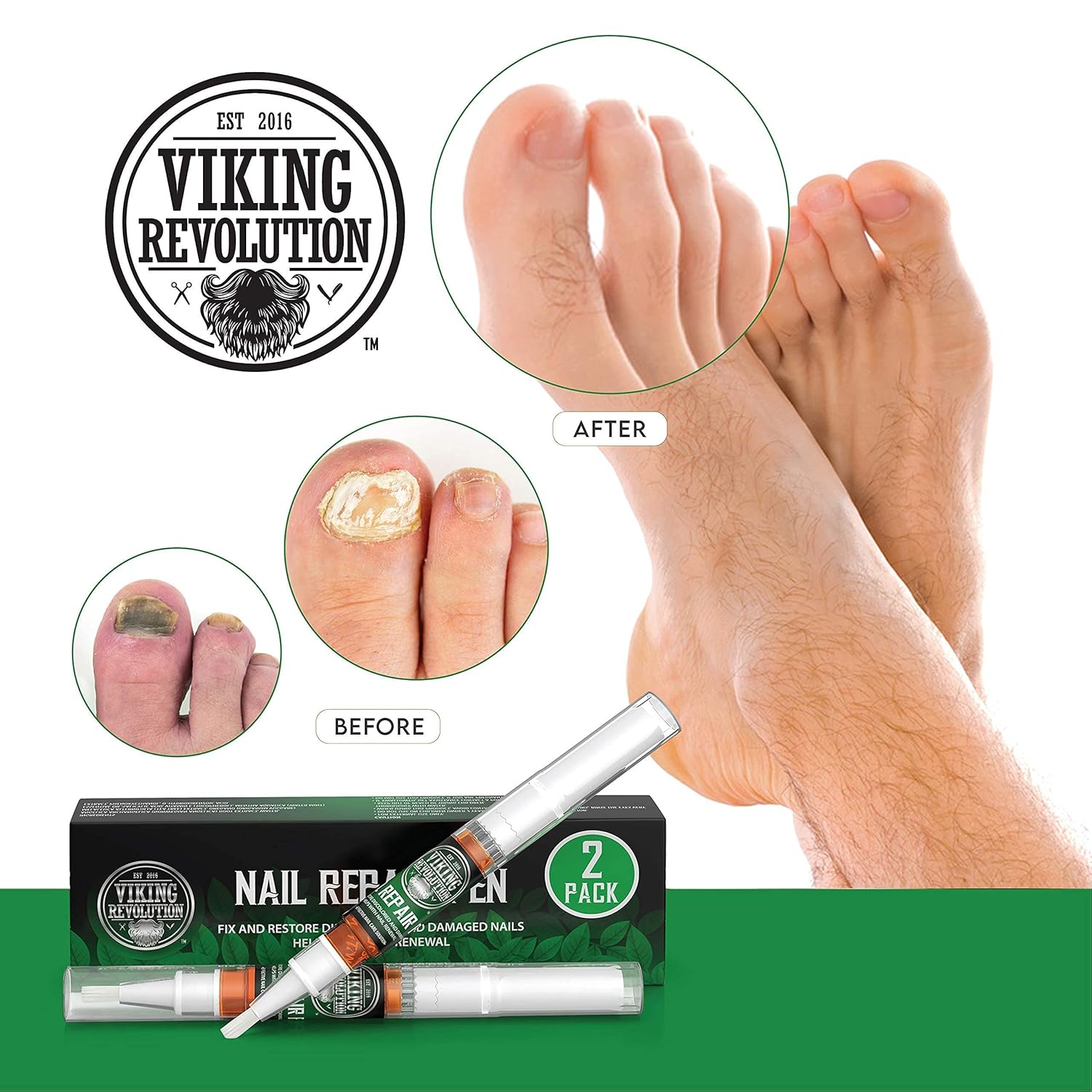 Nail Repair Gel Pen - Toenail Fungus Treatment - Toe and Finger Nail Strengthener, Fixes and Repairs Damaged Brittle Nails - Antifungal Nail Treatment (2 Pens) : Beauty & Personal Care