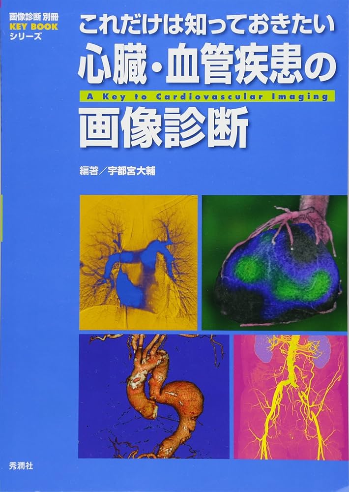 虚血性心疾患の画像診断 : 見て診て学ぶ : CT・MRI・核医学・USで診断… 虚血性心疾患の画像診断 : 見て診て学ぶ : CT・MRI・核医学・US