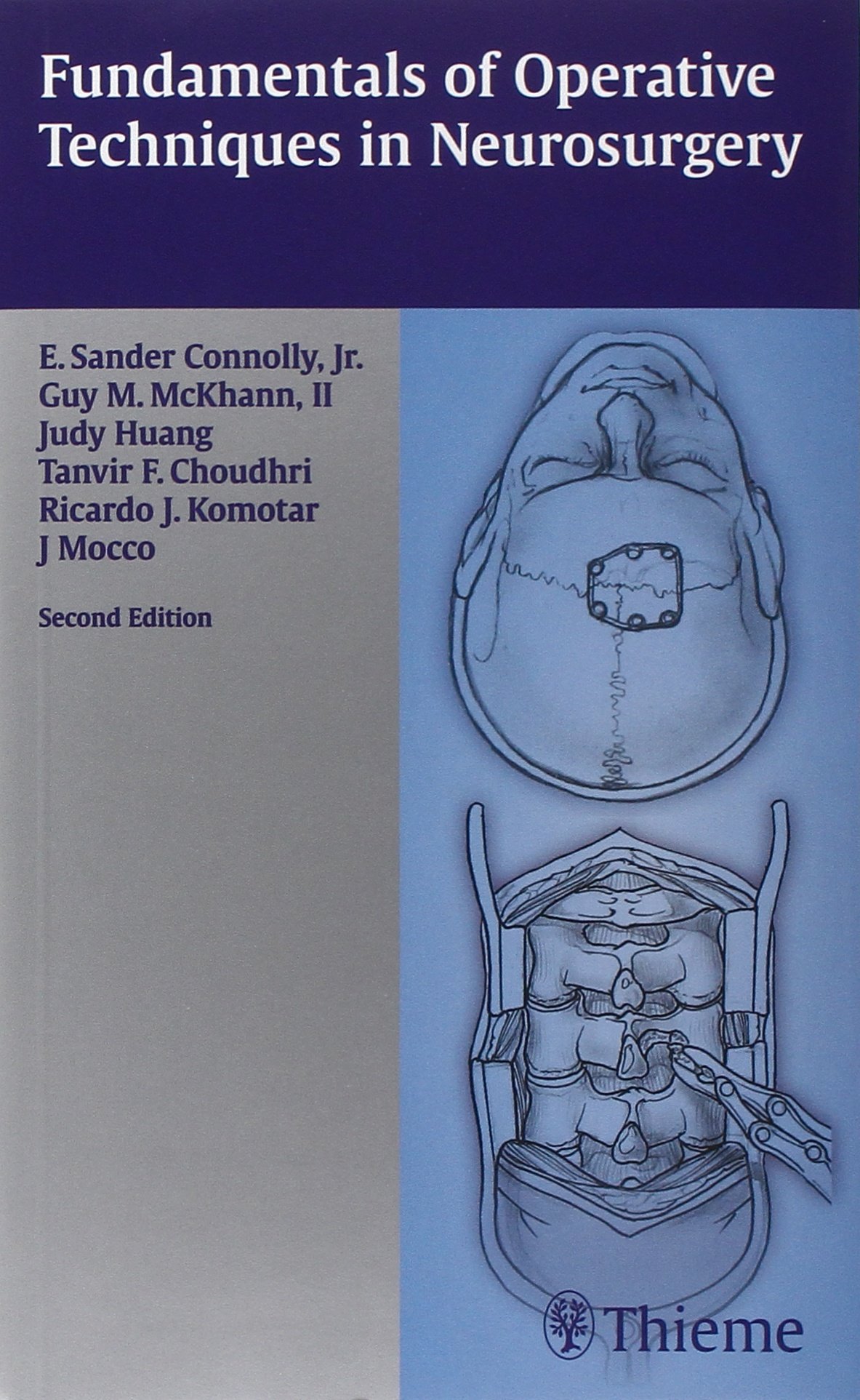 Fundamentals of Operative Techniques in Neurosurgery