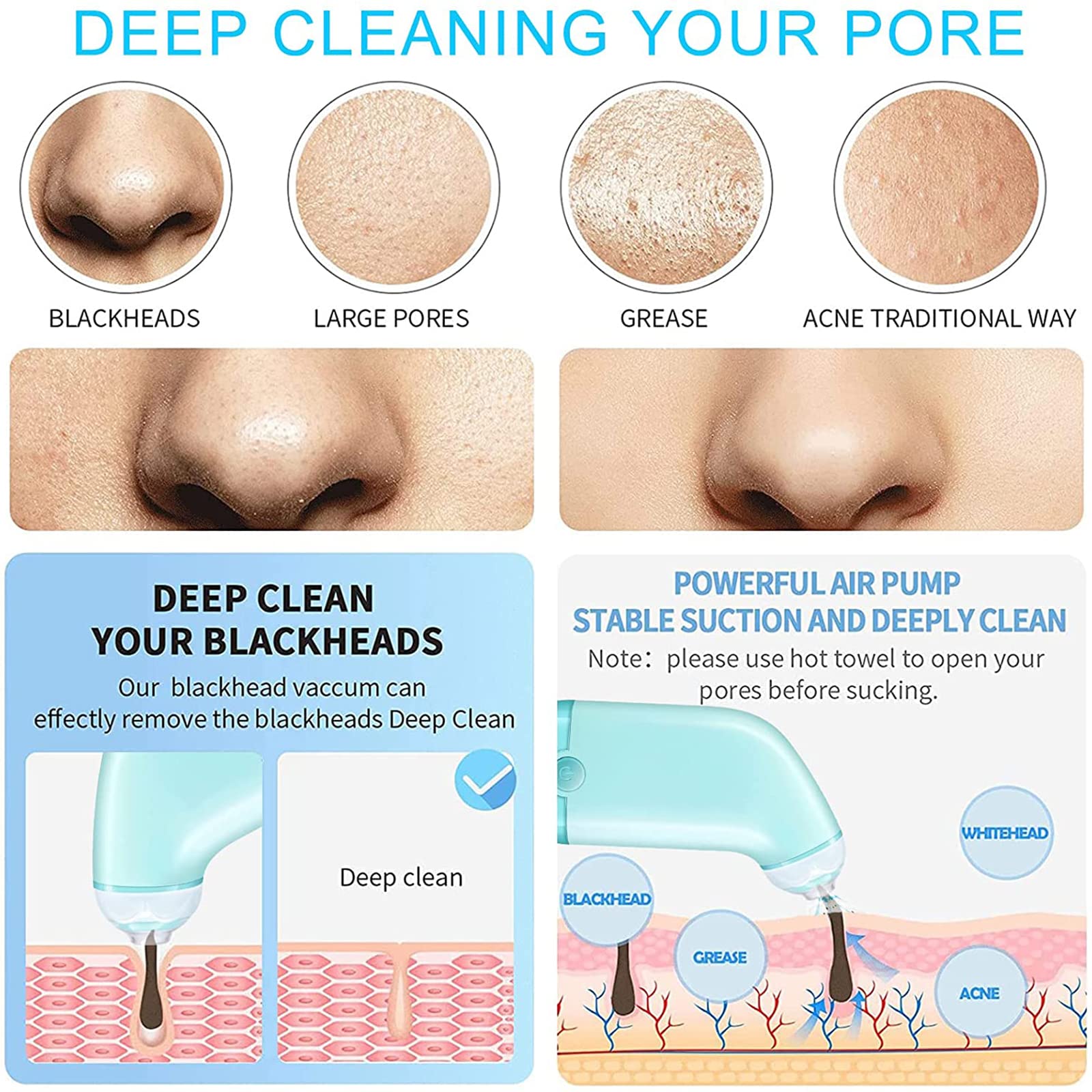 WolFum Limpiador facial de poros: extractor de espinillas de limpieza facial, herramienta de succión de puntos negros, aspiradora de poros para eliminar puntos negros, herramienta extractora de puntos