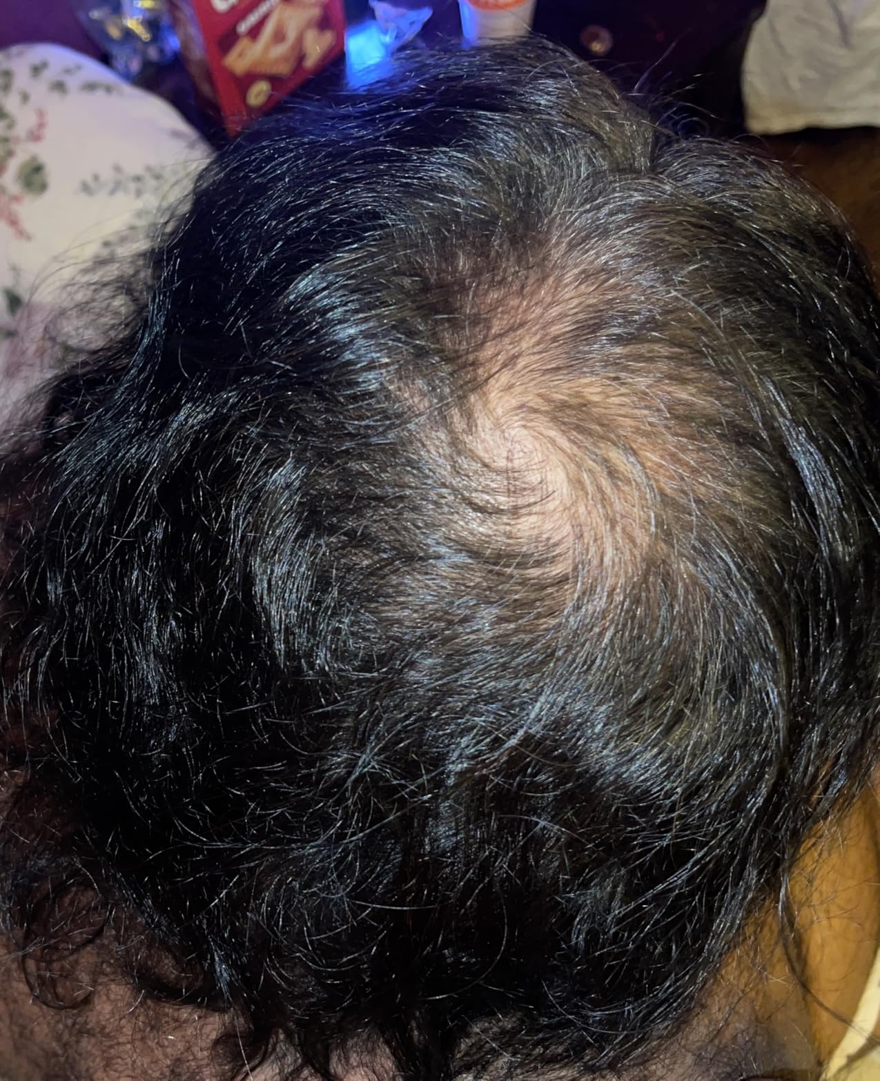 12 Meses de Tratamiento - Transformación completa Argentina