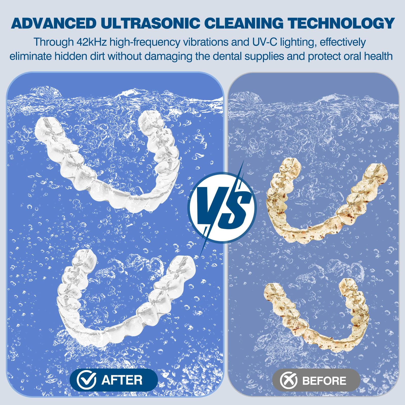 Ultrasonic Retainer Cleaner - Denture & Jewelry Cleaning -6