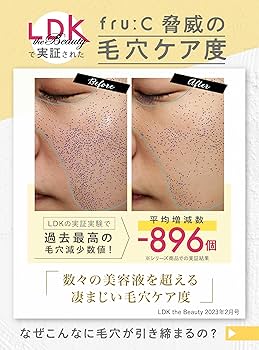 Amazon.co.jp: Fru:C ビタミンドロップ 日本初 28包 ビタミンC美容液