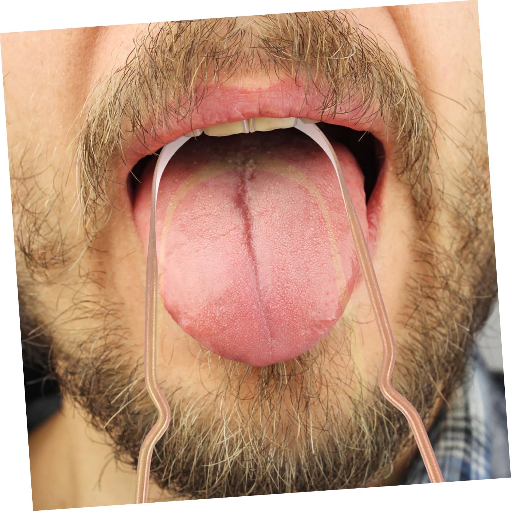 PartyKindom 15pezzi Pulisci Lingua Portatile Rame Con Scatola Di Contenimento Raschietto Ergonomico Per Igiene Orale Per Adulti Riduce Odori Sgradevoli Facile Da Usare