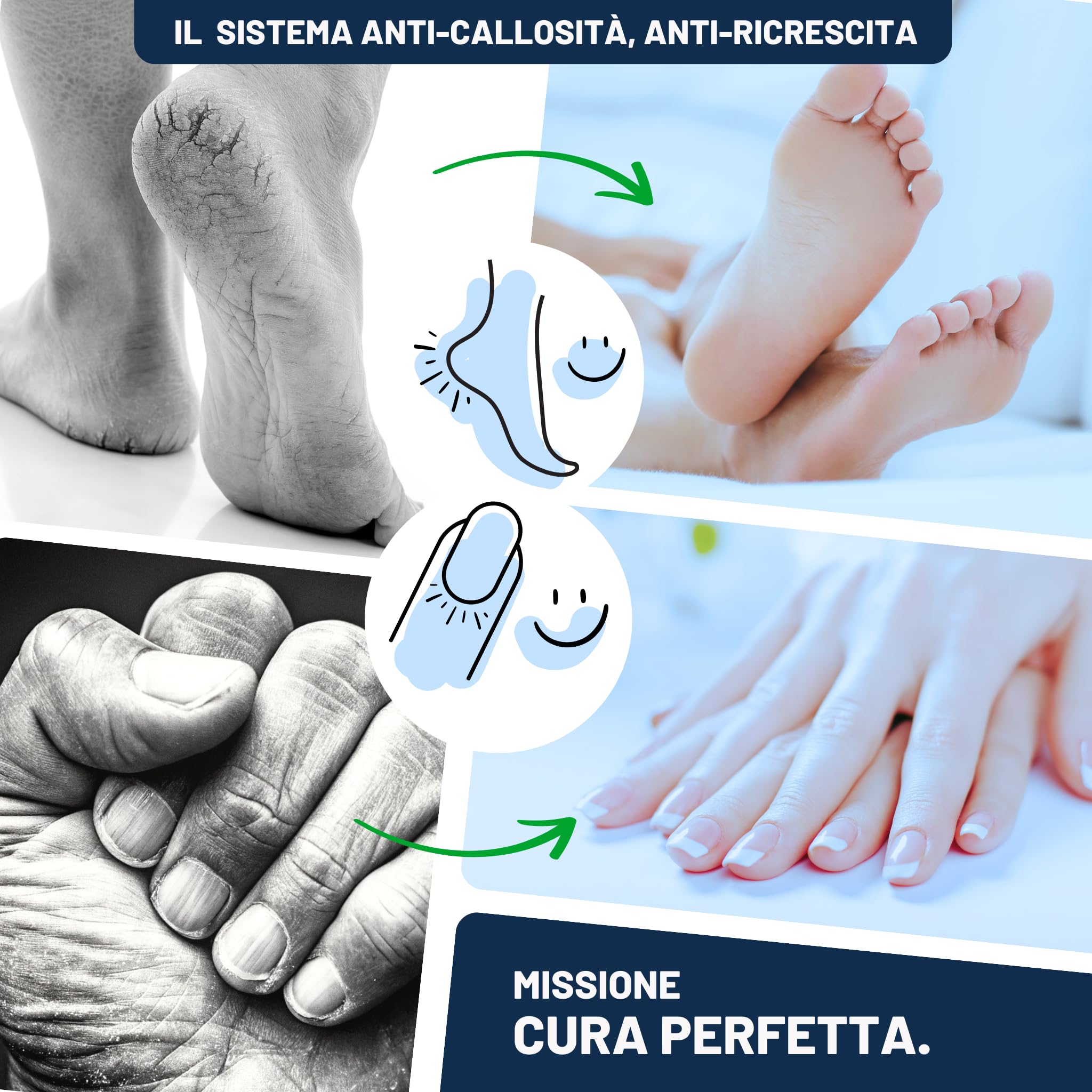 Mr. Fuss® N. 4 – Advanced Pack Complete – Grande, per cuticole e cuticole, confezione risparmio da 5 pezzi, soluzione attiva ammorbidente rapido – 500 ml, balsamo n. 2 – 200 ml, ovatta, set di posate