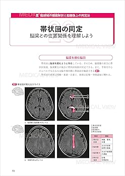 【DVD全２巻セット】リハビリテーションにおける脳画像の活用　●ジャパンライム リハビリテーション医学 第2版 [Vol.11] 脳卒中の回復期 – 医学