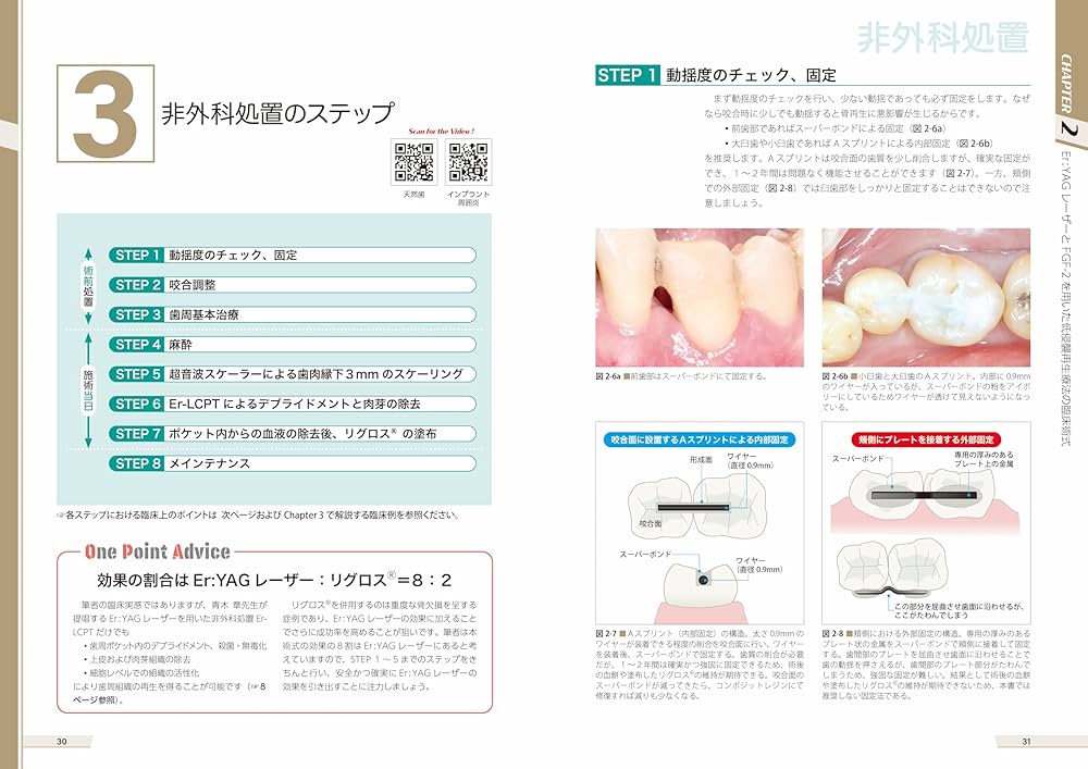 Amazon.co.jp: Er:YAGレーザーとFGF-2による低侵襲再生療法 : 原田