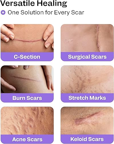 Miniatura 2 de AWD - Tiras de silicona precortadas para cicatrices, 120 pulgadas de longitud total, cinta de cicatrices de grado médico para cicatrices