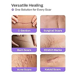 AWD Pre-Cut Silicone Scar Tape Strips - 120in Total Length - Medical Grade Scar Tape for Surgical Scars, Keloids, Postpartum Essentials & Bump Removal - Silicone Scar Sheets (120in Pre-Cut)