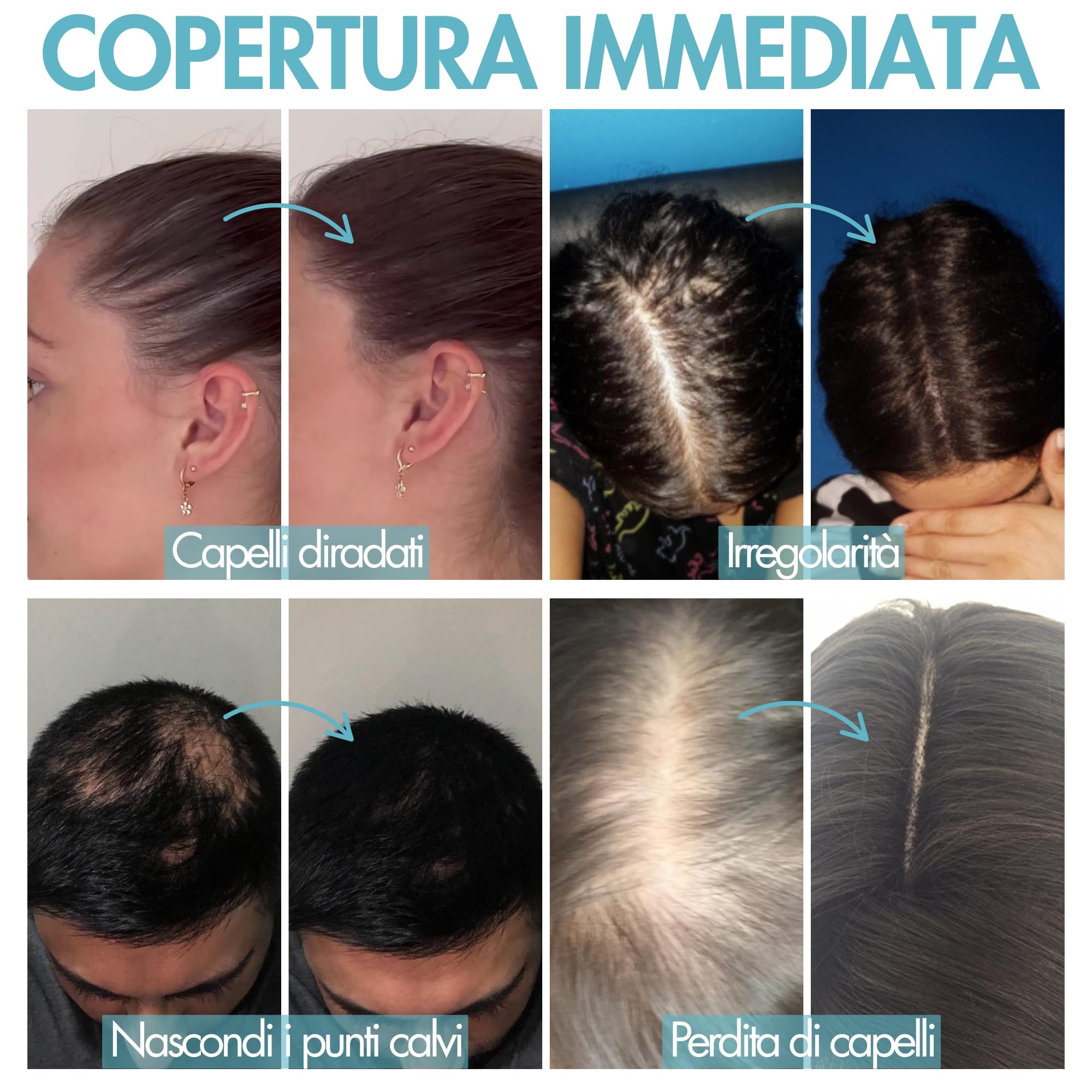 Hair Genetics Ricariche Di Fibre Capelli - Fibre cheratina per capelli per Uomini e Donne con Diradamento e Perdita - Hair Fiber Plus per Copertura Radici e Volume Naturale (50g, Marrone Scuro)