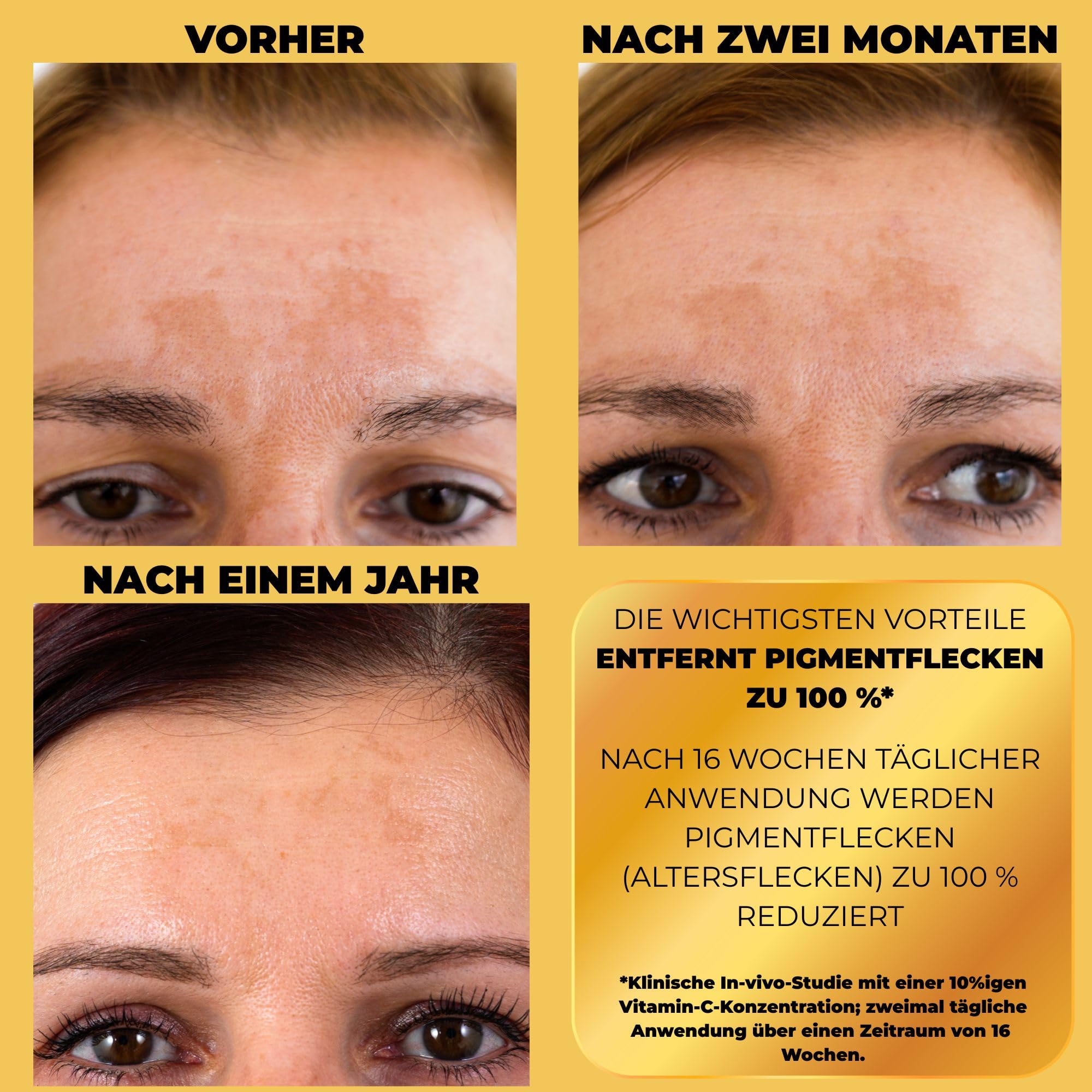 Afrodita Professional C10 Vitamin Super Shot Serum | 10% stabilisiertes Vitamin C Gesichtsserum gegen Pigmentflecken | Aufhellendes Anti-Aging Serum mit Glow-Effekt für alle Hauttypen 30 ml