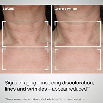 StriVectin Tighten and Lift Advanced Neck Cream PLUS with Alpha-3 Peptides for Neck and Decollete, Smoothing Look of Wrinkles and Fine Lines, Improves Crepey Skin and Vertical Lines