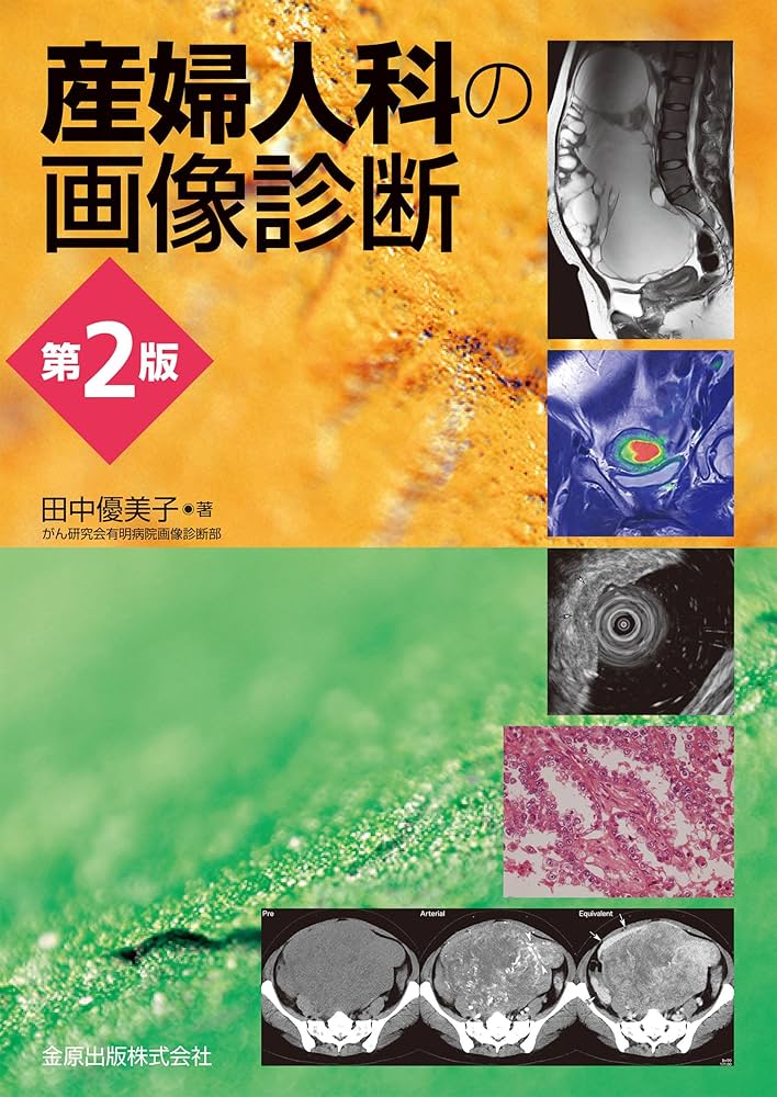 産婦人科の画像診断 産婦人科の画像診断 | 田中優美子 |本 | 通販 | Amazon