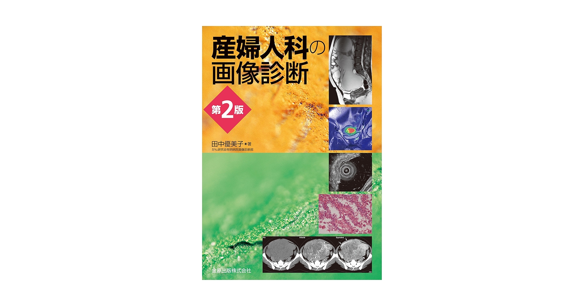 産婦人科の画像診断 第2版 | 田中 優美子 |本 | 通販 | Amazon